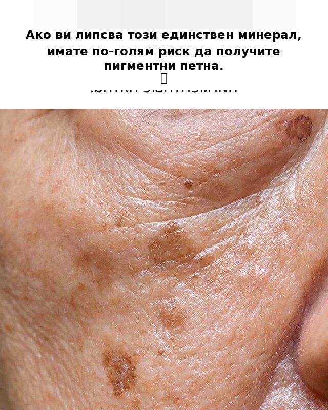 Ако ви липсва този единствен минерал, имате по-голям риск да получите пигментни петна.